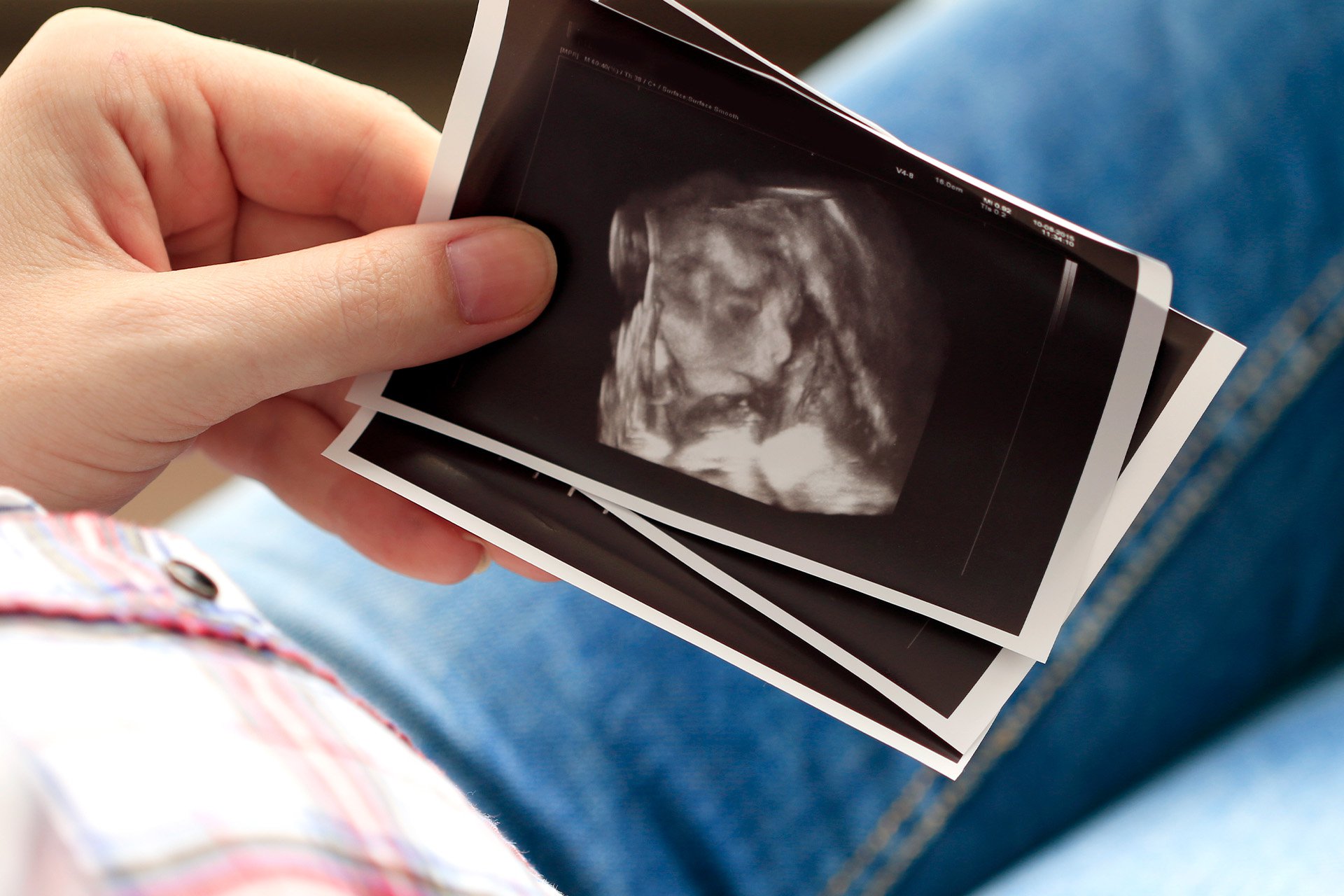 Tipos de ecografías de embarazo y todo lo que debes saber  - 1.jpg