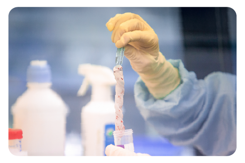 celulas-madre-del-cordon-umbilical-2