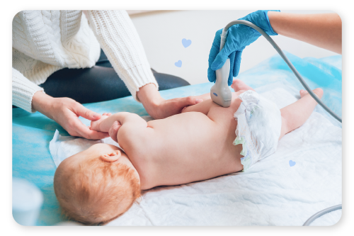displasia-de-cadera-en-bebes-2