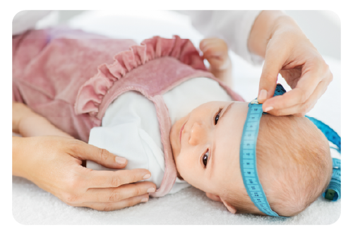 sindrome-de-cabeza-plana-2